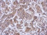 ATG16L1 Antibody in Immunohistochemistry (Paraffin) (IHC (P))