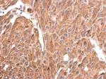 CRMP1 Antibody in Immunohistochemistry (Paraffin) (IHC (P))