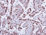 p38 MAPK alpha Antibody in Immunohistochemistry (Paraffin) (IHC (P))