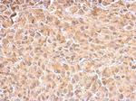 HSPA1A Antibody in Immunohistochemistry (Paraffin) (IHC (P))