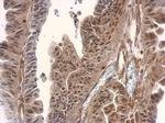 SMAD3 Antibody in Immunohistochemistry (Paraffin) (IHC (P))