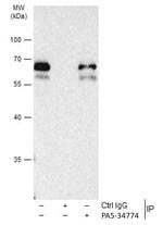 SMAD3 Antibody in Immunoprecipitation (IP)