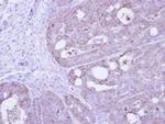 PKM2 Antibody in Immunohistochemistry (Paraffin) (IHC (P))