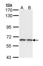 PKM2 Antibody in Western Blot (WB)