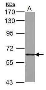 PKM2 Antibody in Western Blot (WB)