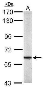 PKM2 Antibody in Western Blot (WB)