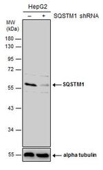 SQSTM1 Antibody