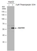 SQSTM1 Antibody in Western Blot (WB)