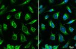 Calreticulin Antibody in Immunocytochemistry (ICC/IF)