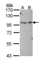 TBCK Antibody in Western Blot (WB)