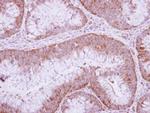 Urokinase Antibody in Immunohistochemistry (Paraffin) (IHC (P))