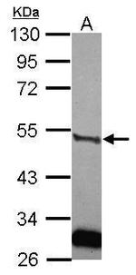 Urokinase Antibody in Western Blot (WB)