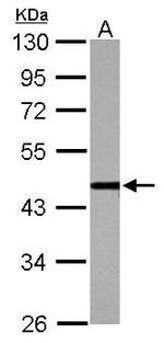 CSTF1 Antibody in Western Blot (WB)