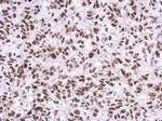 PARP1 Antibody in Immunohistochemistry (Paraffin) (IHC (P))