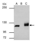 PARP1 Antibody in Immunoprecipitation (IP)