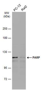 PARP1 Antibody in Western Blot (WB)