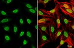 PARP1 Antibody in Immunocytochemistry (ICC/IF)