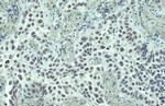 PARP1 Antibody in Immunohistochemistry (Paraffin) (IHC (P))