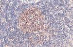 PARP1 Antibody in Immunohistochemistry (Paraffin) (IHC (P))