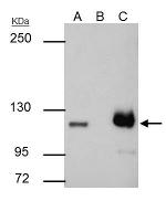 PARP1 Antibody in Immunoprecipitation (IP)