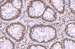 p21 Antibody in Immunohistochemistry (Paraffin) (IHC (P))