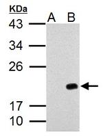 p21 Antibody in Western Blot (WB)