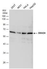 SMAD4 Antibody in Western Blot (WB)