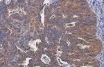 TRADD Antibody in Immunohistochemistry (Paraffin) (IHC (P))