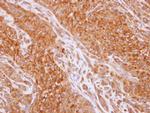 RIP2 Antibody in Immunohistochemistry (Paraffin) (IHC (P))