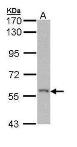 RIP2 Antibody in Western Blot (WB)