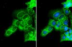 TBK1 Antibody in Immunocytochemistry (ICC/IF)