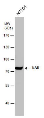 TBK1 Antibody in Western Blot (WB)