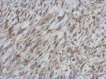 STAT6 Antibody in Immunohistochemistry (Paraffin) (IHC (P))