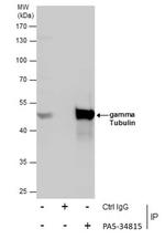 gamma Tubulin Antibody in Immunoprecipitation (IP)