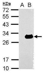 Galectin 3 Antibody in Western Blot (WB)