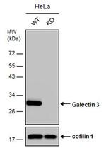 Galectin 3 Antibody