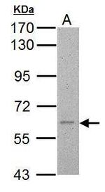 Calcium Channel beta-4 Antibody in Western Blot (WB)