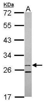 15-PGDH Antibody in Western Blot (WB)