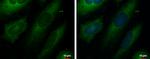 UNG Antibody in Immunocytochemistry (ICC/IF)