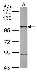 NUP98 Antibody in Western Blot (WB)