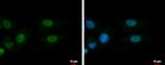 ADARB1 Antibody in Immunocytochemistry (ICC/IF)