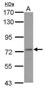 ADARB1 Antibody in Western Blot (WB)