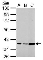 Annexin A3 Antibody in Western Blot (WB)