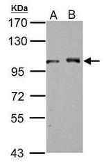 DDX23 Antibody in Western Blot (WB)