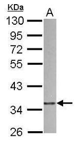 p41-ARCb Antibody in Western Blot (WB)