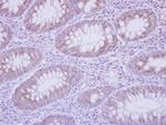 IL17C Antibody in Immunohistochemistry (Paraffin) (IHC (P))