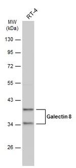 Galectin 8 Antibody in Western Blot (WB)