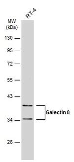 Galectin 8 Antibody in Western Blot (WB)