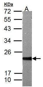 ASF1B Antibody in Western Blot (WB)