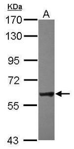 NXF2 Antibody in Western Blot (WB)